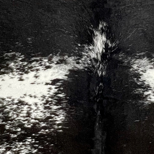Closeup of this extra extra-large Speckled Brazilian Cowhide, showing mostly black, with a few white speckles, across the shoulder and down the middle, and white with black speckles and spots on the back  (BRSP3419)