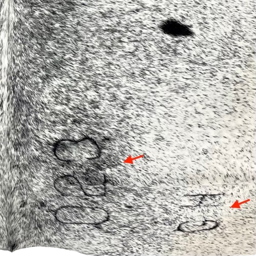 closeup of this Large White and Black Speckled Colombian Cowhide, showing two large brand marks on the right side of the butt (COSP3579)